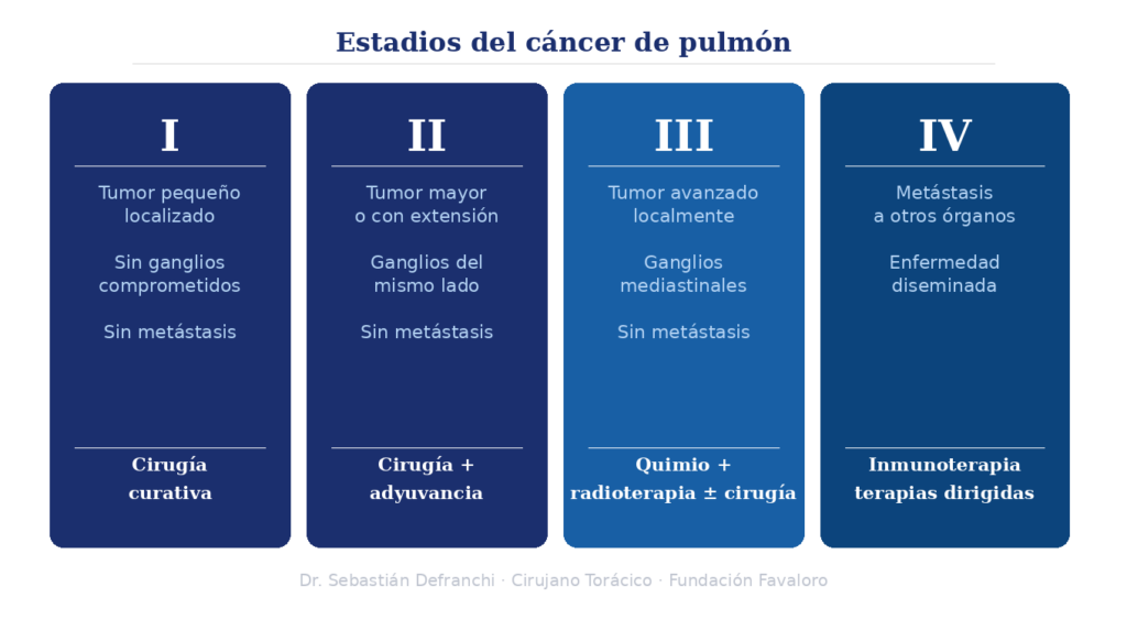 Infografía con los cuatro estadios del cáncer de pulmón: estadio I y II con cirugía curativa, estadio III con tratamiento multimodal, estadio IV con inmunoterapia y terapias dirigidas.